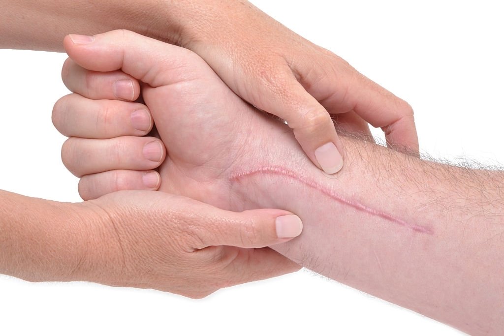 Can Vitamins Help With Post Surgical Scar And Wound Healing Best 